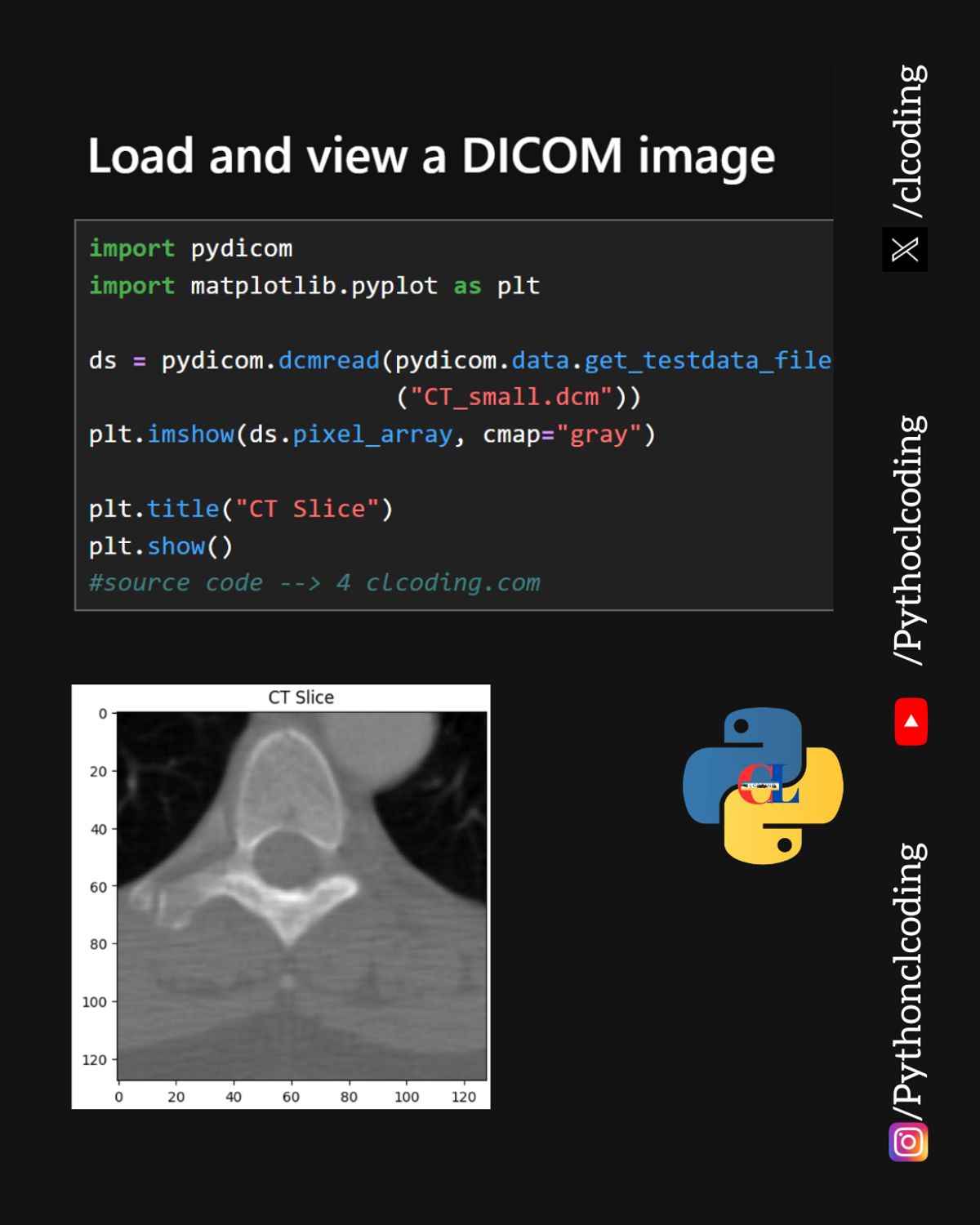 Load and view a DICOM image using Python — Python Coding (CLCODING ...