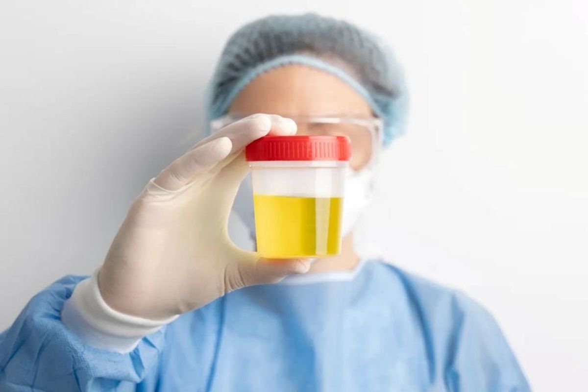 New Urine Test Could Detect Cancer Early — And Even Reveal Whether It Has Spread — Aurel Stratan