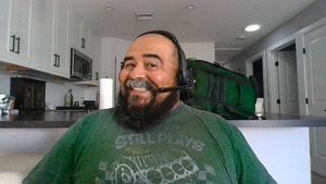 balding