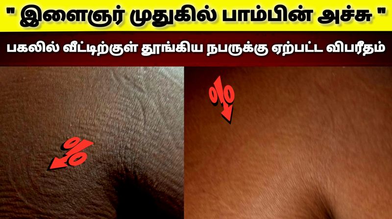 இளைஞர் முதுகில் பாம்பின் அச்சு! 😱