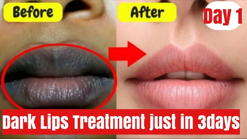 How to get baby soft pink lips at home. https://youtu.be/bXf3aD8jZII