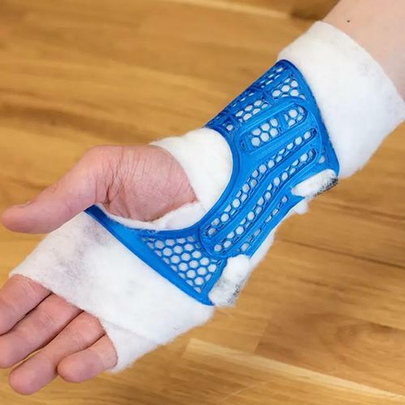 Production of wrist splints