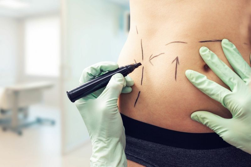 Body Contouring Surgery: Solutions for Stubborn Fat and Skin