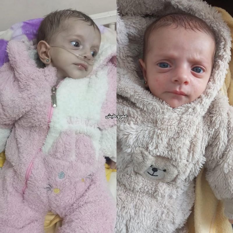 Urgent Medical Appeal - 4 Month Old Baby Amal