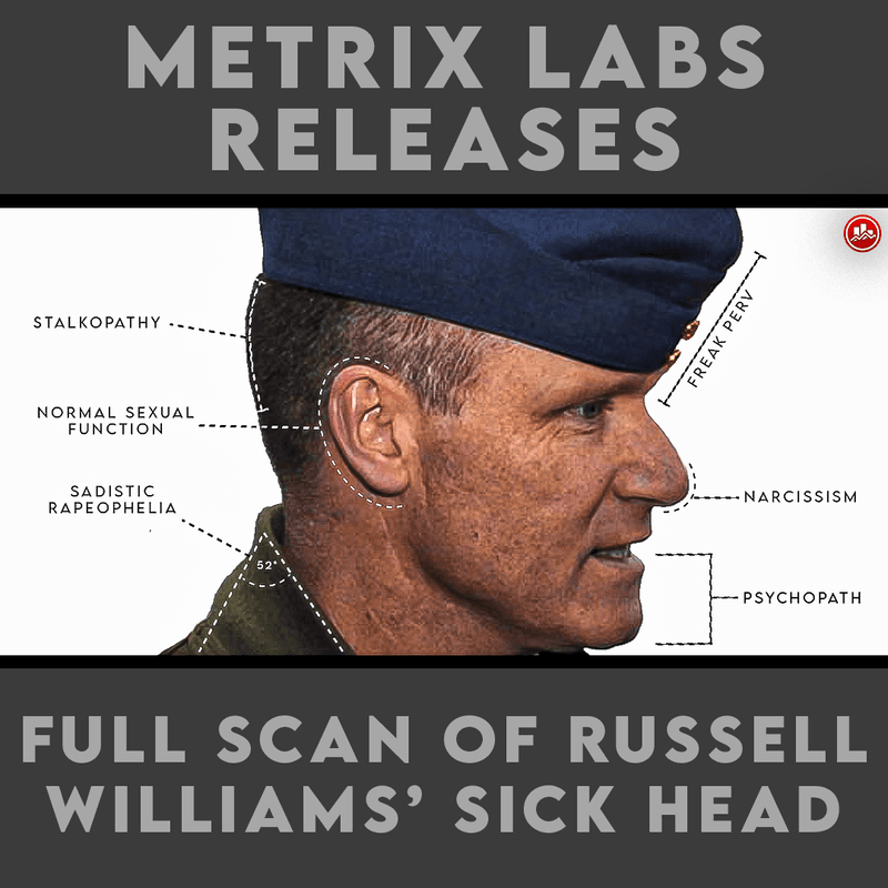🧑‍🔬 Metrix Labs releases full scan of #RussellWilliams' sick head. This is what we found..