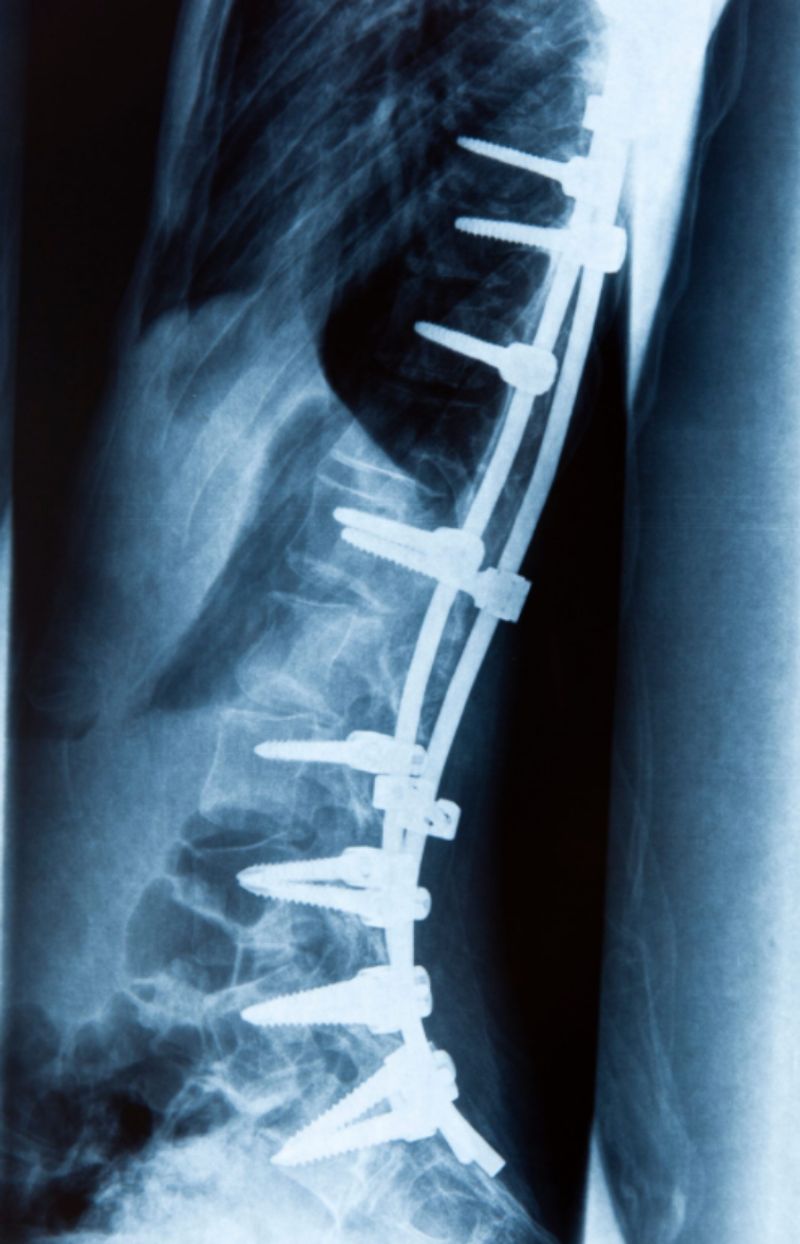 You may never walk again…