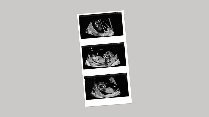 Some news.
