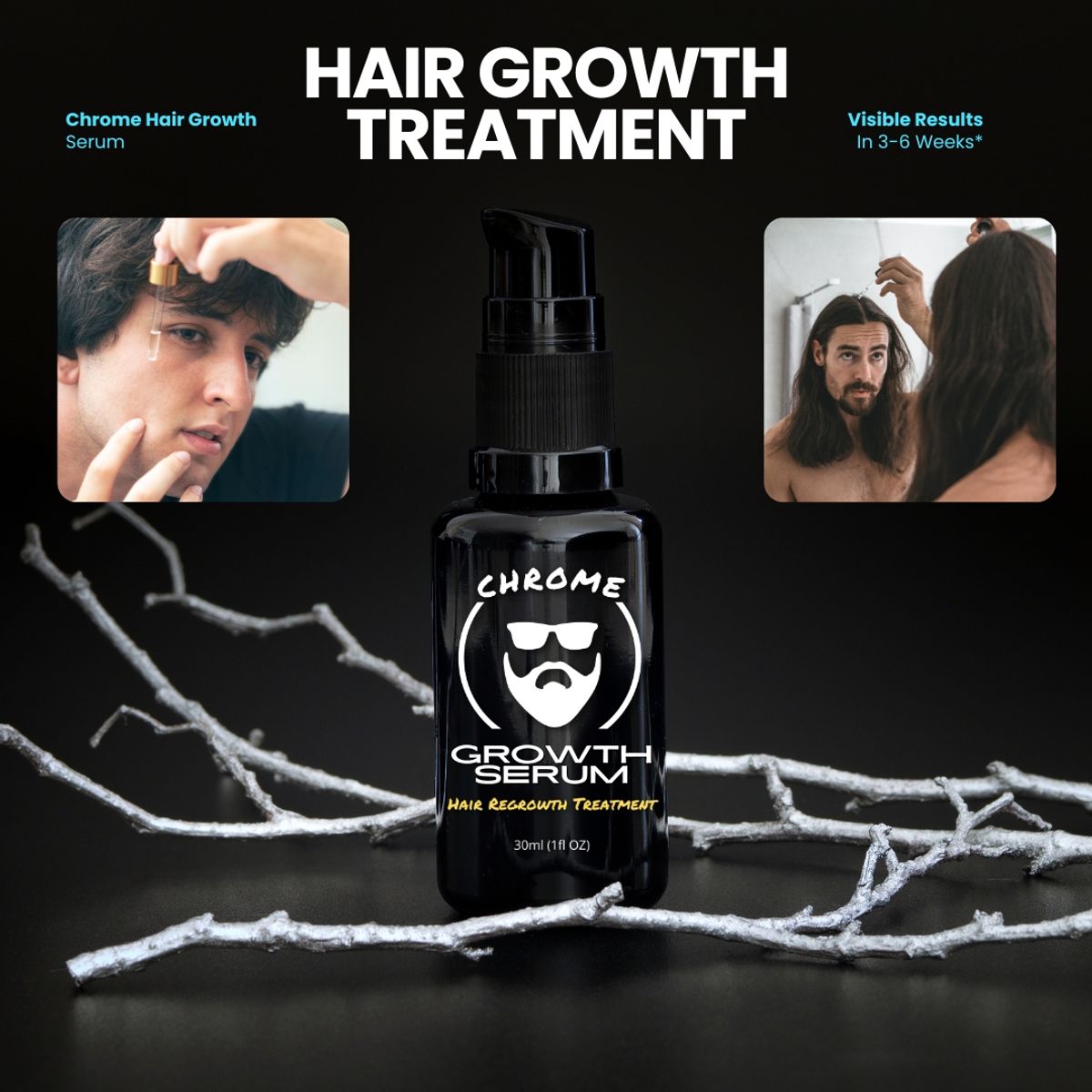 Hair Growth Treatment - 3 Month