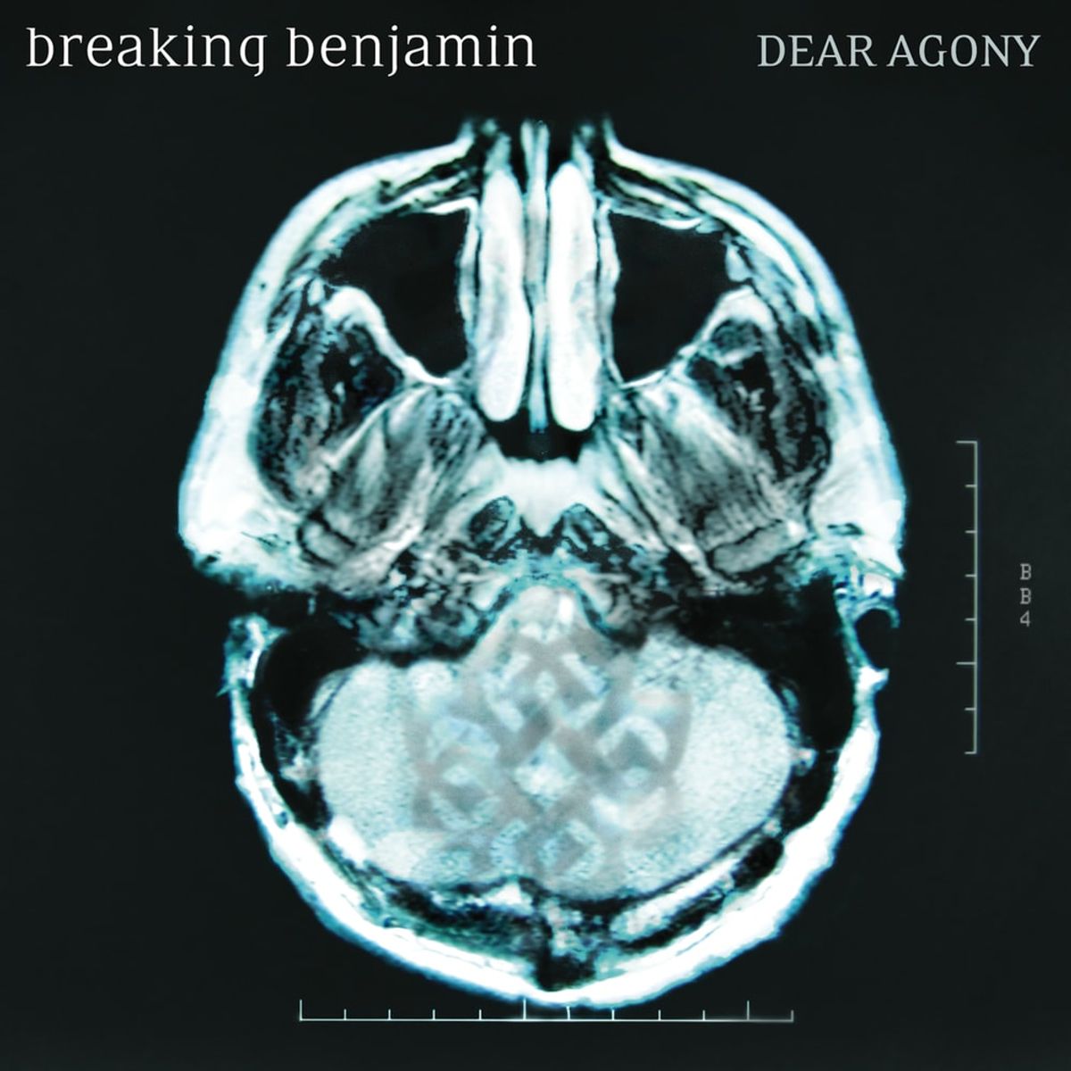 Breaking Benjamin - Dear Agony (Isolated)
